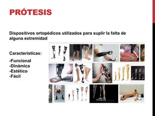 PRÓTESIS
Dispositivos ortopédicos utilizados para suplir la falta de
alguna extremidad
Características:
-Funcional
-Dinámica
-Estético
-Fácil
 