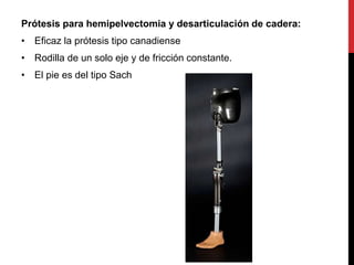 Prótesis para hemipelvectomia y desarticulación de cadera:
• Eficaz la prótesis tipo canadiense
• Rodilla de un solo eje y de fricción constante.
• El pie es del tipo Sach
 