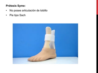 Prótesis Syme:
• No posee articulación de tobillo
• Pie tipo Sach
 