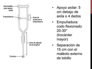 • Apoyo axilar: 5
cm debajo de
axila o 4 dedos
• Empuñadura:
codo flexionado
20-30°
(trocánter
mayor)
• Separación de
15 cm con el
maléolo externo
de tobillo
 