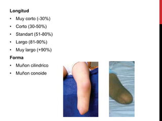 Longitud
• Muy corto (-30%)
• Corto (30-50%)
• Standart (51-80%)
• Largo (81-90%)
• Muy largo (+90%)
Forma
• Muñon cilindrico
• Muñon conoide
 