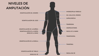 NIVELES DE
AMPUTACIÓN
 