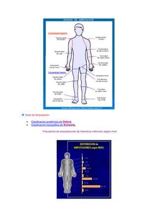 Nivel de Amputación:
 Clasificación anatómica de Oxford.
 Clasificación topográfica de Schwartz.
Frecuencia de amputaciones de miembros inferiores según nivel
 