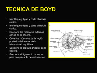 TECNICA DE BOYD 
• Identifique y ligue y corte el nervio 
ciático. 
• Identifique y ligue y corte el nervio 
ciático. 
• Seccione los rotadores externos 
cortos de la cadera. 
• Corte los músculos de la región 
posterior del a nivel de la 
tuberosidad isquiática. 
• Seccione la capsula articular de la 
cadera. 
• Seccione el ligamento redondo 
para completar la desarticulación. 
 