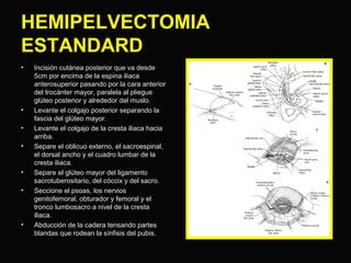 HEMIPELVECTOMIA 
ESTANDARD 
• Incisión cutánea posterior que va desde 
5cm por encima de la espina iliaca 
anterosuperior pasando por la cara anterior 
del trocánter mayor, paralela al pliegue 
glúteo posterior y alrededor del muslo. 
• Levante el colgajo posterior separando la 
fascia del glúteo mayor. 
• Levante el colgajo de la cresta iliaca hacia 
arriba. 
• Separe el oblicuo externo, el sacroespinal, 
el dorsal ancho y el cuadro lumbar de la 
cresta iliaca. 
• Separe el glúteo mayor del ligamento 
sacrotuberositario, del cóccix y del sacro. 
• Seccione el psoas, los nervios 
genitofemoral, obturador y femoral y el 
tronco lumbosacro a nivel de la cresta 
iliaca. 
• Abducción de la cadera tensando partes 
blandas que rodean la sínfisis del pubis. 
 
