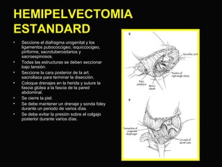 HEMIPELVECTOMIA 
ESTANDARD 
• Seccione el diafragma urogenital y los 
ligamentos pubococcigeo, isquiccocigeo, 
piriforme, sacrotuberositarios y 
sacroespinosos. 
• Todas las estructuras se deben seccionar 
bajo tensión. 
• Seccione la cara posterior de la art. 
sacroiliaca para terminar la disección. 
• Coloque drenajes en la herida y suture la 
fascia glútea a la fascia de la pared 
abdominal. 
• Se cierre la piel. 
• Se debe mantener un drenaje y sonda foley 
durante un periodo de varios días. 
• Se debe evitar la presión sobre el colgajo 
posterior durante varios días. 
 