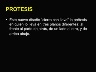 PROTESIS 
• Este nuevo diseño “cierra con llave” la prótesis 
en quien lo lleva en tres planos diferentes: al 
frente al parte de atrás, de un lado al otro, y de 
arriba abajo. 
 