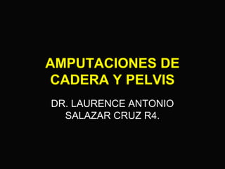 AMPUTACIONES DE 
CADERA Y PELVIS 
DR. LAURENCE ANTONIO 
SALAZAR CRUZ R4. 
 