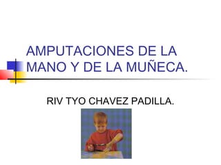 AMPUTACIONES DE LA 
MANO Y DE LA MUÑECA. 
RIV TYO CHAVEZ PADILLA. 
 