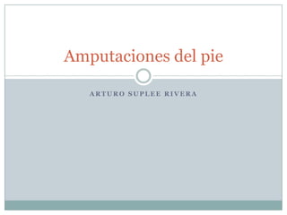 Arturo suplee rivera<br />Amputaciones del pie<br />