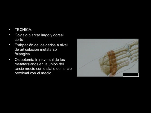 Adelgazar los ejercicios deportivos