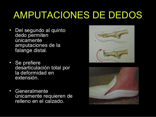 Realmente adelgazar del carbón activo