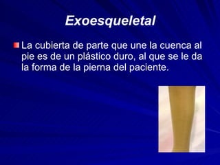Exoesqueletal <ul><li>La cubierta de parte que une la cuenca al pie es de un plástico duro, al que se le da la forma de la...