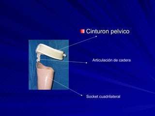 <ul><li>Cinturon pelvico </li></ul>Socket cuadrilateral Articulación de cadera 