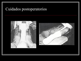 Cuidados postoperatorios 
 