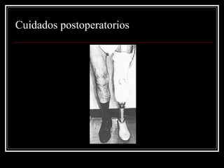 Cuidados postoperatorios 
 