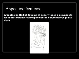 Aspectos técnicos 
Amputación Radial: Elimina al dedo y todos o algunos de 
los metatarsianos correspondientes del primero y quinto 
dedo 
 