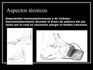 Aspectos técnicos 
Amputación transmetatarsianas y de Lisfranc 
(tarsometatarsiano): Acortan el brazo de palanca del pie 
razón por la cual es necesario alargar el tendón calcáneo. 
 
