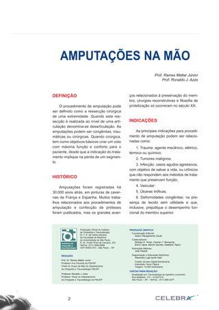 DEFINIÇÃO
O procedimento de amputação pode
ser definido como a ressecção cirúrgica
de uma extremidade. Quando esta res-
secção é realizada ao nível de uma arti-
culação denomina-se desarticulação. As
amputações podem ser congênitas, trau-
máticas ou cirúrgicas. Quando cirúrgica,
tem como objetivos básicos criar um coto
com máxima função e conforto para o
paciente, desde que a indicação do trata-
mento implique na perda de um segmen-
to.
HISTÓRICO
Amputações foram registradas há
30.000 anos atrás, em pinturas de caver-
nas da França e Espanha. Muitos traba-
lhos relacionados aos procedimentos de
amputação e confecção de próteses
foram publicados, mas os grandes avan-
ços relacionados à preservação do mem-
bro, cirurgias reconstrutivas e filosofia de
protetização só ocorreram no século XX.
INDICAÇÕES
As principais indicações para procedi-
mento de amputação podem ser relacio-
nadas como:
1. Trauma: agente mecânico, elétrico,
térmico ou químico;
2. Tumores malígnos;
3. Infecção: casos agudos agressivos,
com objetivo de salvar a vida, ou crônicos
que não respondem aos métodos de trata-
mento que preservam função;
4. Vascular:
5. Úlceras tróficas;
6. Deformidades congênitas: na pre-
sença de tecido sem utilidade e que,
inclusive, prejudique o desempenho fun-
cional do membro superior.
2
AMPUTAÇÕES NA MÃO
Publicação Oficial do Instituto
de Ortopedia e Traumatologia
Dr. F. E. de Godoy Moreira
da Faculdade de Medicina
da Universidade de São Paulo.
R. Dr. Ovidio Pires de Campos, 333
Tel/Fax: (011) 3069-6888
CEP 05403-010 – São Paulo – SP
REDAÇÃO:
Prof. Dr. Rames Mattar Junior
Professor livre Docente da FMUSP
Chefe do Grupo de Mão do Departamento
de Ortopedia e Traumatologia FMUSP
Professor Ronaldo J. Azze
Professor Titular do Departamento
de Ortopedia e Traumatologia da FMUSP
PRODUÇÃO GRÁFICA:
Coordenação Editorial:
Ábaco Planejamento Visual
Colaboradores:
Rodrigo R. Tonan, Carmen T. Bornacina,
Bruno Vigna, Marize Zanotto, Adalberto Tojero.
Ilustrações Médicas:
José Falcetti
Diagramação e Editoração Eletrônica:
Alexandre Lugó Ayres Neto
Fotolito: Bureau Digital Bandeirante
Impressão: Nova Página
Tiragem: 10.000 exemplares
CARTAS PARA REDAÇÃO:
Atualização em Traumatologia do Aparelho Locomotor
Rua Batataes, 174 – 01423-010
São Paulo – SP – Tel/Fax.: (011) 885-4277
Prof. Rames Mattar Júnior
Prof. Ronaldo J. Azze
 