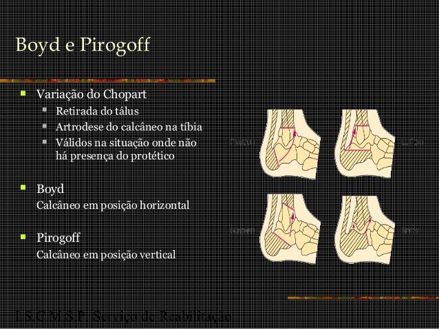Reabilitação em amputados