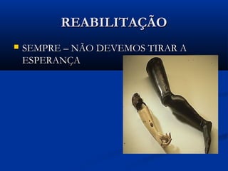 REABILITAÇÃO


SEMPRE – NÃO DEVEMOS TIRAR A
ESPERANÇA

 