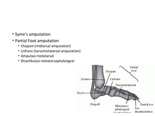 Amputation extremity | PPT