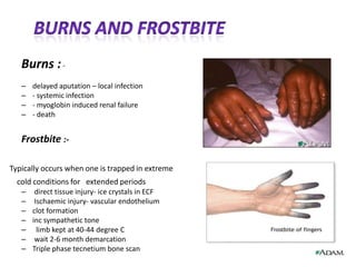     OpenGuillotine           modified guillotine    Closed amputation           revised           plannedTypes of amputation