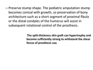 Prompt, uncomplicated wound healing Control of edemaControl of Postoperative pain Prevention of joint contractures Rapid rehabilitationGoals of Postoperative Management 