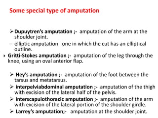 interpelviabdominal amputation ;-  amputation of the thigh with excision of the lateral half of the pelvis. 