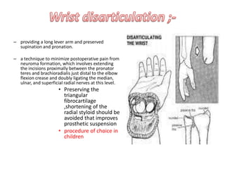 amputation of the foot at the ankle, part of the calcaneus being left in the stump.Pirogoff amputation