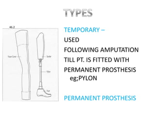 PROSTHESISIT IS A REPLACEMENT OF SUBSTITUTION OF A MISSING OR A DISEASED PART
