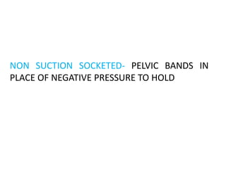 TEMPORARY –USED  FOLLOWING AMPUTATIONTILL PT. IS FITTED WITH             PERMANENT PROSTHESIS eg;PYLONPERMANENT PROSTHESIS46.2TYPES