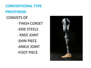 SUCION SOCKETED-LESS SKIN INFECTION-FEEL OF CLOSE CONTACT  WITH PROSTHESIS-SOCKS ARE NOT NECESSSARY-NOT EASY TO WEAR-LESS COMFORTABLENON SUCTION SOCKETED-MORE INCIDENCE OF SKIN INFECTION-NOT SO-NECESSARY-EASY TO WEAR-MORE COMFORTABLECAMPARISON FOR SUCTION SOCKETED PROSTHESIS WITH NON SUCTION SOCKETED