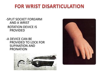 ELBOW PIECE CAN BE FLEXED B PULLING ON THE FLEXION CORD WITH THE PROTRACTORS      OF TH SHOULDER-HANDPIECE EITHER COSMETIC OR SPLINT HOOK TYPE.SHOULDER DISARTICULATION