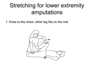 Amputation | PPT