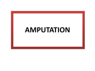 AMPUTATION
 