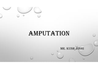 AMPUTATION
MR. KUSH JOSHI
 