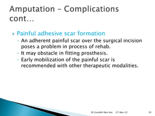 Scar Prothesis AMPUTATION.pptx