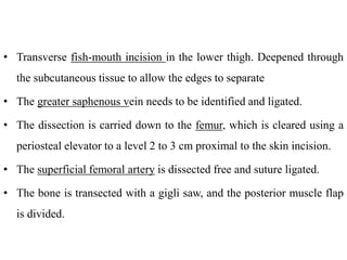 • Transverse fish-mouth incision in the lower thigh. Deepened through
the subcutaneous tissue to allow the edges to separate
• The greater saphenous vein needs to be identified and ligated.
• The dissection is carried down to the femur, which is cleared using a
periosteal elevator to a level 2 to 3 cm proximal to the skin incision.
• The superficial femoral artery is dissected free and suture ligated.
• The bone is transected with a gigli saw, and the posterior muscle flap
is divided.
 