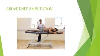 ABOVE KNEE AMPUTATION
 