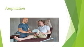 Amputation
 
