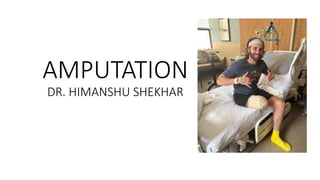 AMPUTATION
DR. HIMANSHU SHEKHAR
 