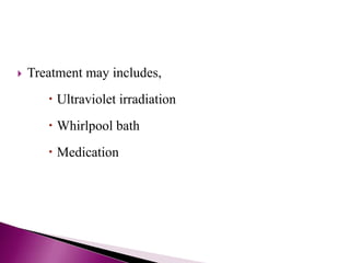  Treatment may includes,
 Ultraviolet irradiation
 Whirlpool bath
 Medication
 