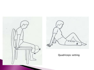 Quadriceps setting
 