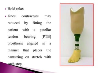 Hold relax
 Knee contracture may
reduced by fitting the
patient with a patellar
tendon bearing [PTB]
prosthesis aligned in a
manner that places the
hamstring on stretch with
each step.
 