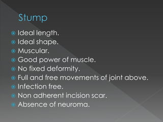  Ideal length.
 Ideal shape.
 Muscular.
 Good power of muscle.
 No fixed deformity.
 Full and free movements of joint above.
 Infection free.
 Non adherent incision scar.
 Absence of neuroma.
 