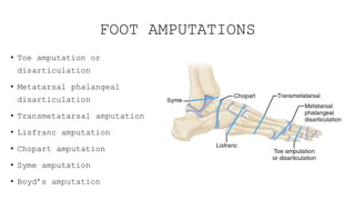 Amputation Topic Orthopaedics Presentation | PPTX