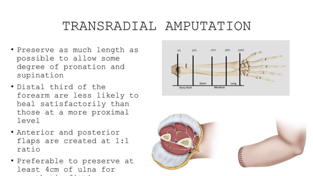Amputation Topic Orthopaedics Presentation PPTX Death Injury Or amputation-topic-orthopaedics-presentation-pptx-death-injury-or