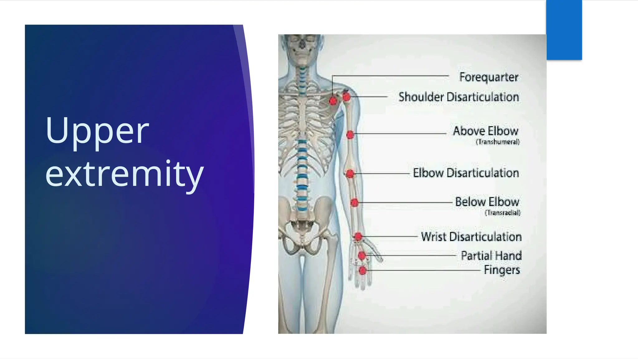 Upper
extremity
 