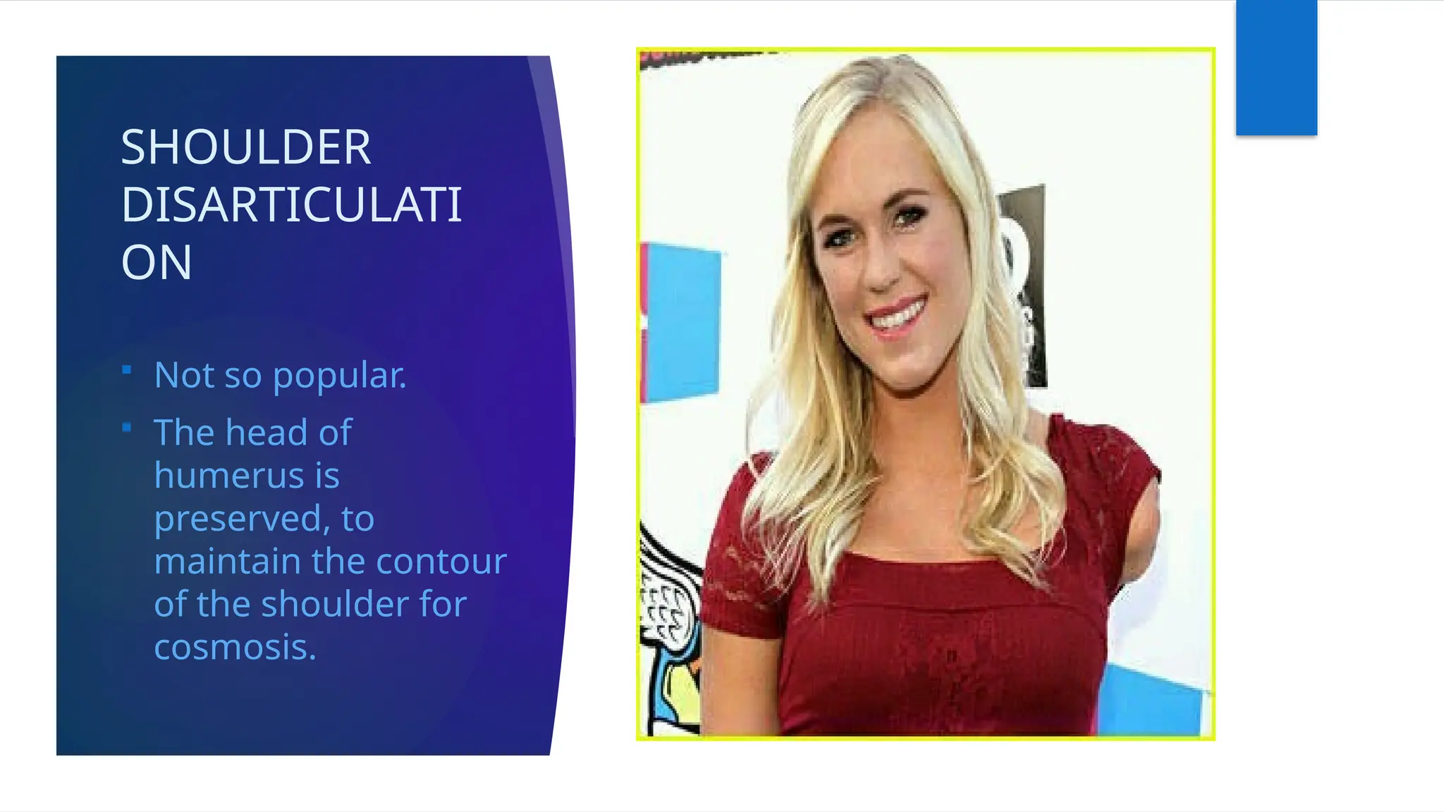 SHOULDER
DISARTICULATI
ON
 Not so popular.
 The head of
humerus is
preserved, to
maintain the contour
of the shoulder for
cosmosis.
 